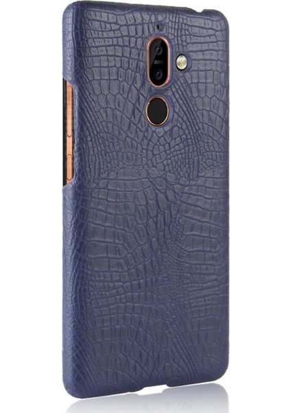 Nokia 7 Plus Anti Scratch Klasik Timsah Kapağı Için Şık Klasik Kılıf (Yurt Dışından) modelleri
