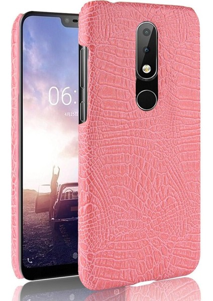 Nokia 5.1 Plus /nokia X5 Classic Timsah Anti Için Şık Klasik Kılıf (Yurt Dışından)