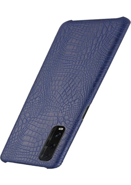 Oppo Bulmak Için Şık Klasik Durumda X2 Uyumluluk Anti Scratch Klasik (Yurt Dışından)