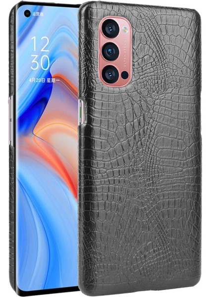 Oppo Reno4 Pro 5g Için Şık Klasik Durumda Koruyucu Kapak Anti Scratch (Yurt Dışından)