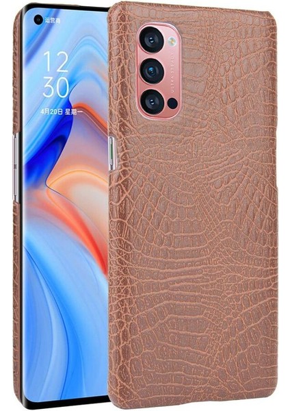 Oppo Reno4 Pro 5g Için Şık Klasik Durumda Koruyucu Kapak Anti Scratch (Yurt Dışından)
