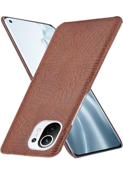 Xiaomi Mi 11 Klasik Timsah Moda Anti Kapak Için Şık Klasik Durumda (Yurt Dışından) modelleri