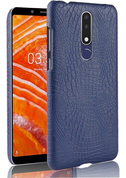 Nokia 3.1 Plus Anti Scratch Klasik Timsah Için Şık Klasik Kılıf (Yurt Dışından)