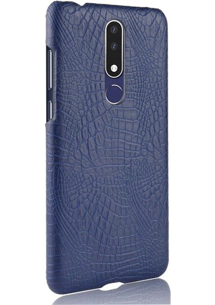 Nokia 3.1 Plus Anti Scratch Klasik Timsah Için Şık Klasik Kılıf (Yurt Dışından)