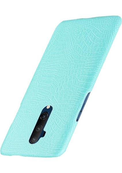 Oneplus 7t Pro Koruyucu Kapak Için Şık Klasik Kılıf Klasik Timsah (Yurt Dışından)
