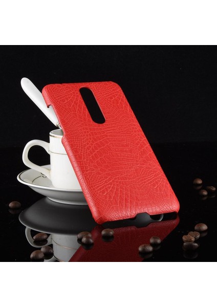 Nokia 3.1 Plus Anti Scratch Klasik Timsah Için Şık Klasik Kılıf (Yurt Dışından)