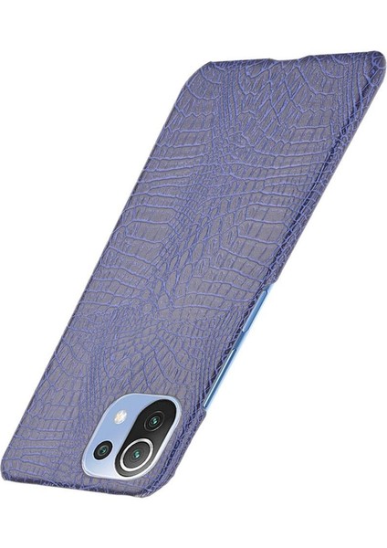Xiaomi Mi 11 Lite Klasik Timsah Moda Kapak Için Şık Klasik Durumda (Yurt Dışından) modelleri