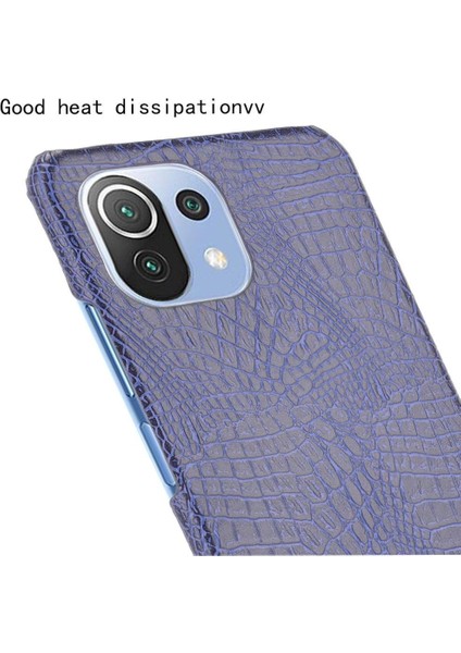 Xiaomi Mi 11 Lite Klasik Timsah Moda Kapak Için Şık Klasik Durumda (Yurt Dışından) indirimleri
