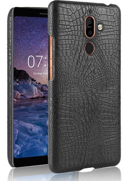 Nokia 7 Plus Anti Scratch Klasik Timsah Kapağı Için Şık Klasik Kılıf (Yurt Dışından)