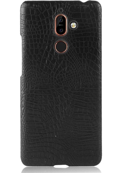 Nokia 7 Plus Anti Scratch Klasik Timsah Kapağı Için Şık Klasik Kılıf (Yurt Dışından) fiyatları