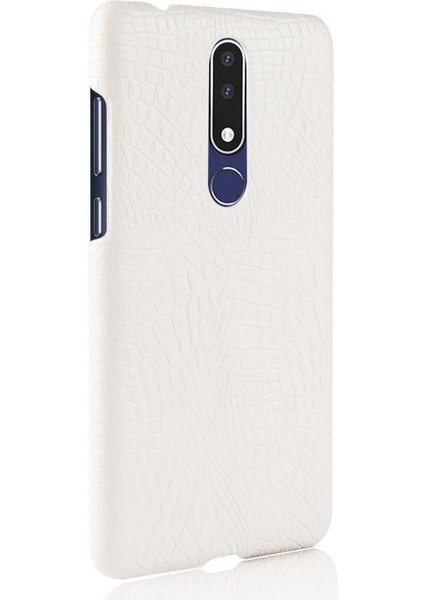 Nokia 3.1 Plus Anti Scratch Klasik Timsah Için Şık Klasik Kılıf (Yurt Dışından)