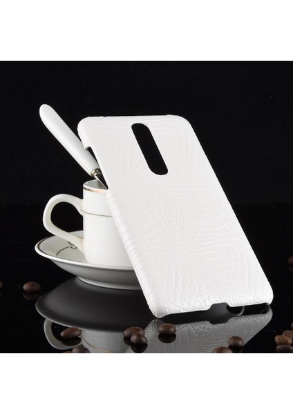 Nokia 3.1 Plus Anti Scratch Klasik Timsah Için Şık Klasik Kılıf (Yurt Dışından)