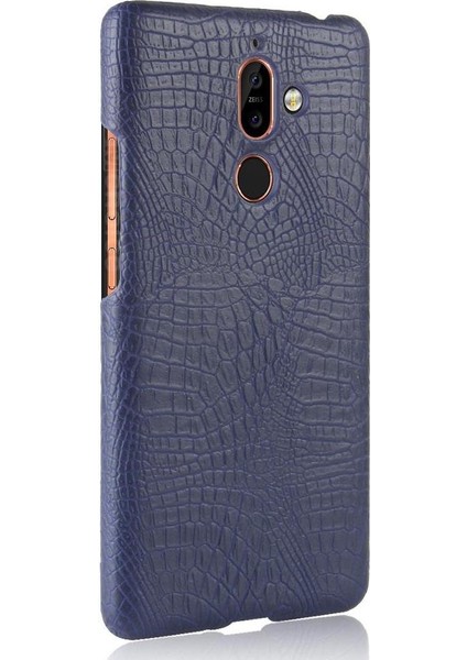 Nokia 7 Plus Anti Scratch Klasik Timsah Kapağı Için Şık Klasik Kılıf (Yurt Dışından) modelleri