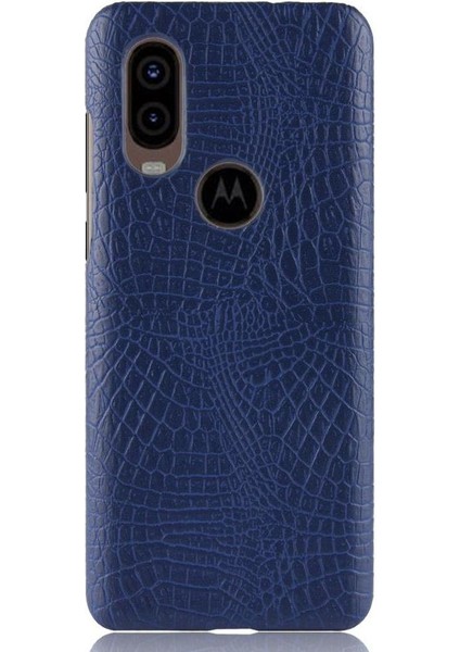 Motorola One Vision Klasik Timsah Moda Için Şık Klasik Kılıf (Yurt Dışından) modelleri