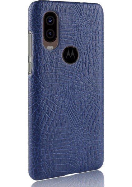 Motorola One Vision Klasik Timsah Moda Için Şık Klasik Kılıf (Yurt Dışından) fırsatları