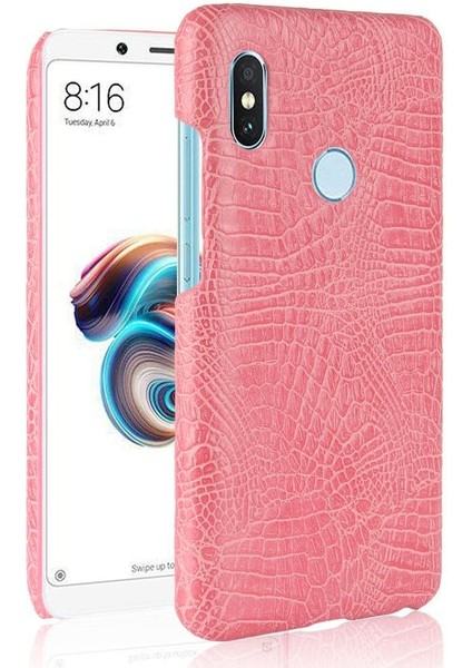 Xiaomi Redmi Not 5 Pro Anti Scratch Koruyucu Için Şık Klasik Durumda (Yurt Dışından)