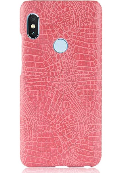 Xiaomi Redmi Not 5 Pro Anti Scratch Koruyucu Için Şık Klasik Durumda (Yurt Dışından)