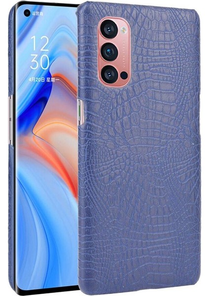 Oppo Reno4 Pro 5g Için Şık Klasik Durumda Koruyucu Kapak Anti Scratch (Yurt Dışından)