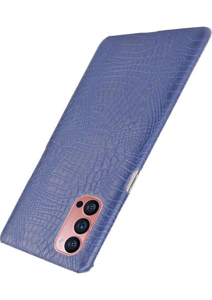 Oppo Reno4 Pro 5g Için Şık Klasik Durumda Koruyucu Kapak Anti Scratch (Yurt Dışından)