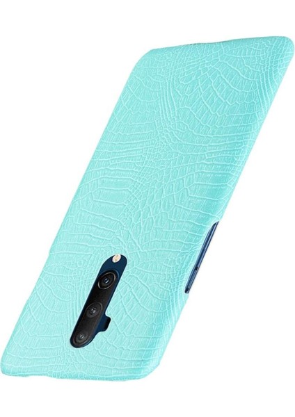 Oneplus 7t Pro Koruyucu Kapak Için Şık Klasik Kılıf Klasik Timsah (Yurt Dışından)