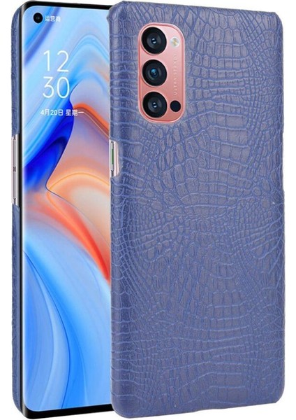 Oppo Reno4 Pro 5g Için Şık Klasik Durumda Koruyucu Kapak Anti Scratch (Yurt Dışından)