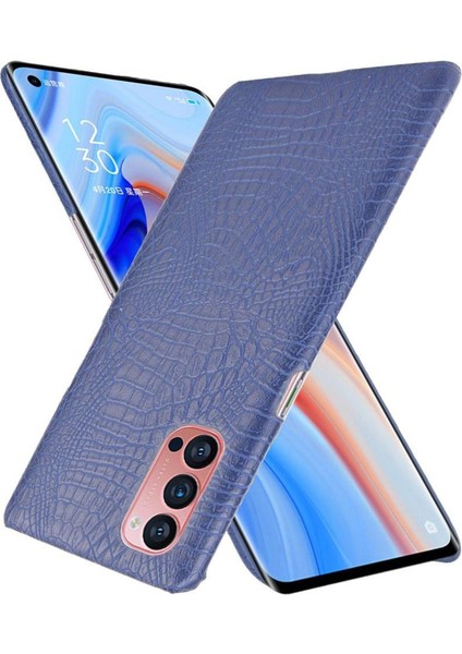 Oppo Reno4 Pro 5g Için Şık Klasik Durumda Koruyucu Kapak Anti Scratch (Yurt Dışından)