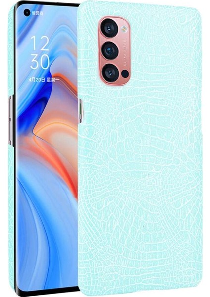 Oppo Reno4 Pro 5g Için Şık Klasik Durumda Koruyucu Kapak Anti Scratch (Yurt Dışından)