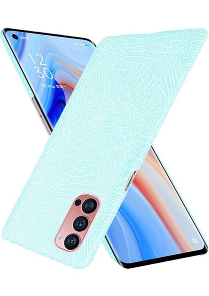 Oppo Reno4 Pro 5g Için Şık Klasik Durumda Koruyucu Kapak Anti Scratch (Yurt Dışından)