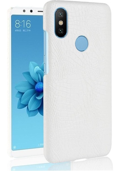 Xiaomi A2 Telefon Kılıfı (Yurt Dışından)