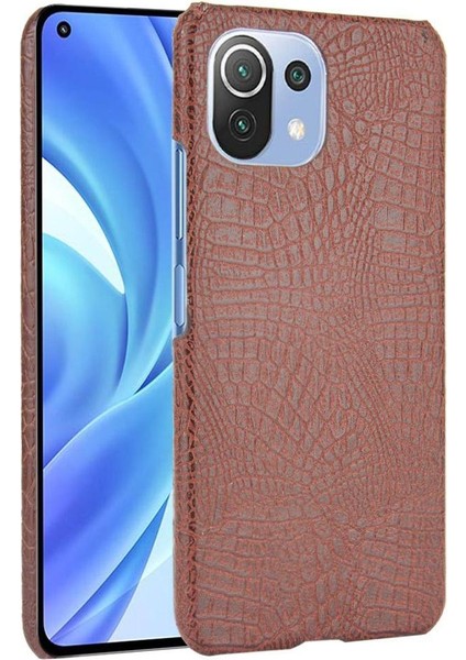 Xiaomi 11 Lite Telefon Kılıfı (Yurt Dışından)