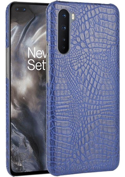 Oneplus Nord Koruyucu Kapak Anti Scratch Için Şık Klasik Kılıf (Yurt Dışından)