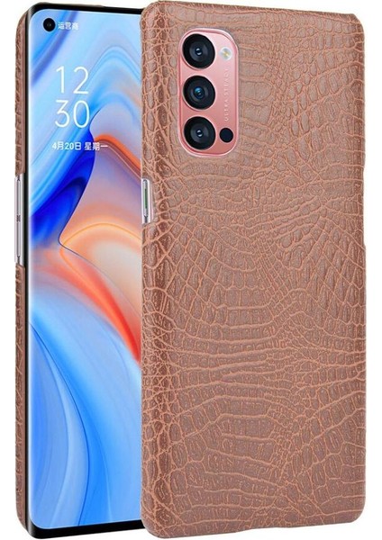 Oppo Reno4 Pro 5g Için Şık Klasik Durumda Koruyucu Kapak Anti Scratch (Yurt Dışından)