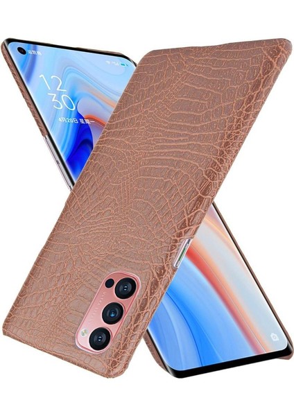 Oppo Reno4 Pro 5g Için Şık Klasik Durumda Koruyucu Kapak Anti Scratch (Yurt Dışından) modelleri