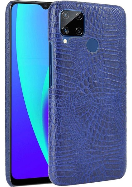 Realme C15 Anti Scratch Klasik Timsah Moda Için Şık Klasik Durumda (Yurt Dışından)