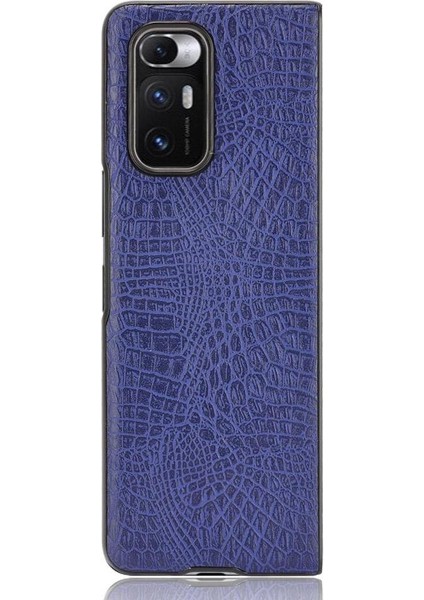 Xiaomi Mi Mix Kat Klasik Timsah Moda Anti Için Şık Klasik Durumda (Yurt Dışından) fiyatları