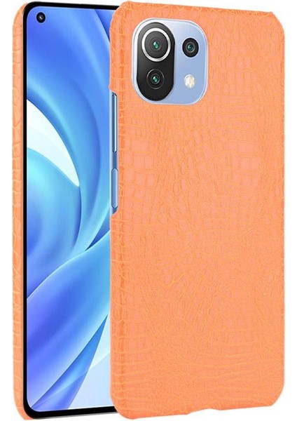 Xiaomi Mi 11 Lite Klasik Timsah Moda Kapak Için Şık Klasik Durumda (Yurt Dışından)
