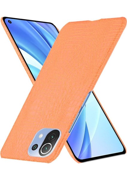 Xiaomi Mi 11 Lite Klasik Timsah Moda Kapak Için Şık Klasik Durumda (Yurt Dışından) modelleri