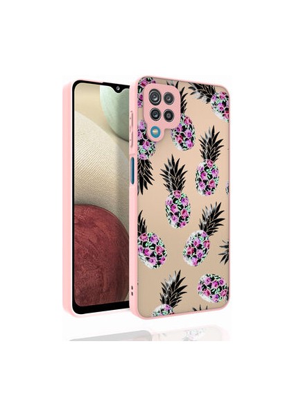 Redmi Note 11 Global Kılıf Desenli Kamera Korumalı Nora Kapak