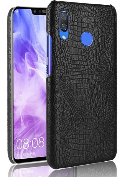 Huawei Nova 3 Uyumluluk Için Şık Klasik Kılıf Koruyucu Kapak Anti (Yurt Dışından)