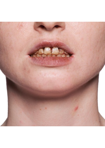 Tooth Enamel 12 ml Brown