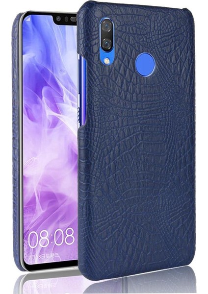 Huawei Nova 3 Uyumluluk Için Şık Klasik Kılıf Koruyucu Kapak Anti (Yurt Dışından)