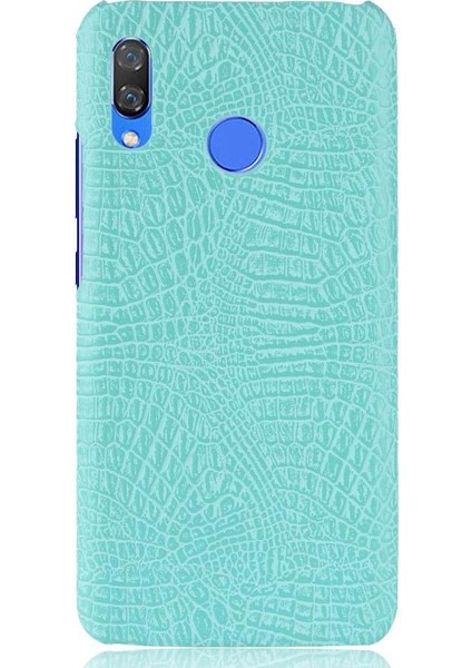 Huawei Nova 3 Uyumluluk Için Şık Klasik Kılıf Koruyucu Kapak Anti (Yurt Dışından) fiyatları