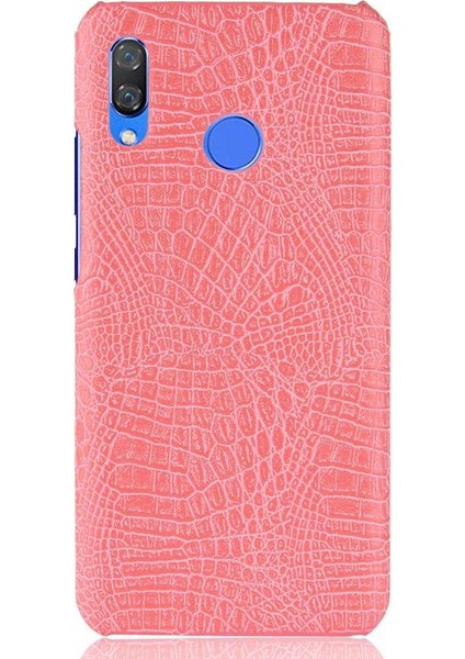 Huawei Nova 3 Uyumluluk Için Şık Klasik Kılıf Koruyucu Kapak Anti (Yurt Dışından)