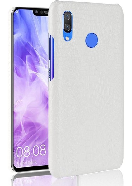 Huawei Nova 3 Uyumluluk Için Şık Klasik Kılıf Koruyucu Kapak Anti (Yurt Dışından)