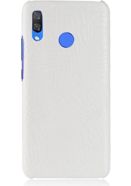 Huawei Nova 3 Uyumluluk Için Şık Klasik Kılıf Koruyucu Kapak Anti (Yurt Dışından)