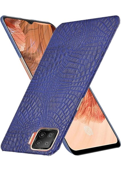 Oppo A73 Klasik Timsah Moda Koruyucu Için Şık Klasik Kılıf (Yurt Dışından)