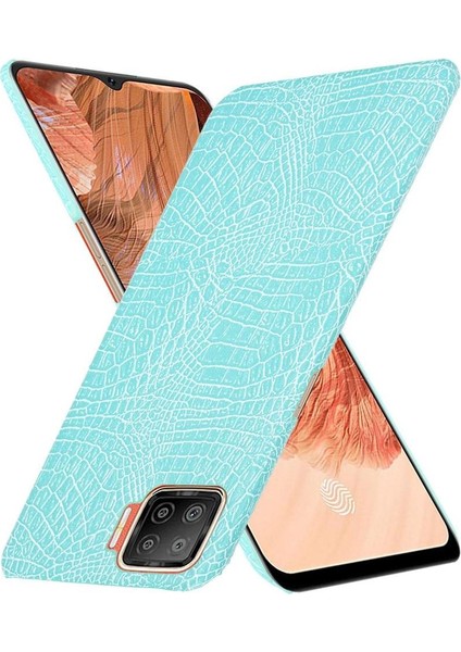 Oppo A73 Klasik Timsah Moda Koruyucu Için Şık Klasik Kılıf (Yurt Dışından)