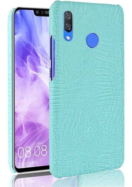 Huawei Nova 3 Uyumluluk Için Şık Klasik Kılıf Koruyucu Kapak Anti (Yurt Dışından)