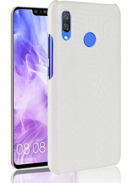 Huawei Nova 3 Uyumluluk Için Şık Klasik Kılıf Koruyucu Kapak Anti (Yurt Dışından)