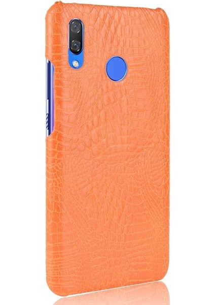 Huawei Nova 3 Uyumluluk Için Şık Klasik Kılıf Koruyucu Kapak Anti (Yurt Dışından) fiyatları